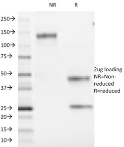 CD1a Antibody (66IIC7), Novus Biologicals 0.2mg; Unlabeled:Antibodies,
